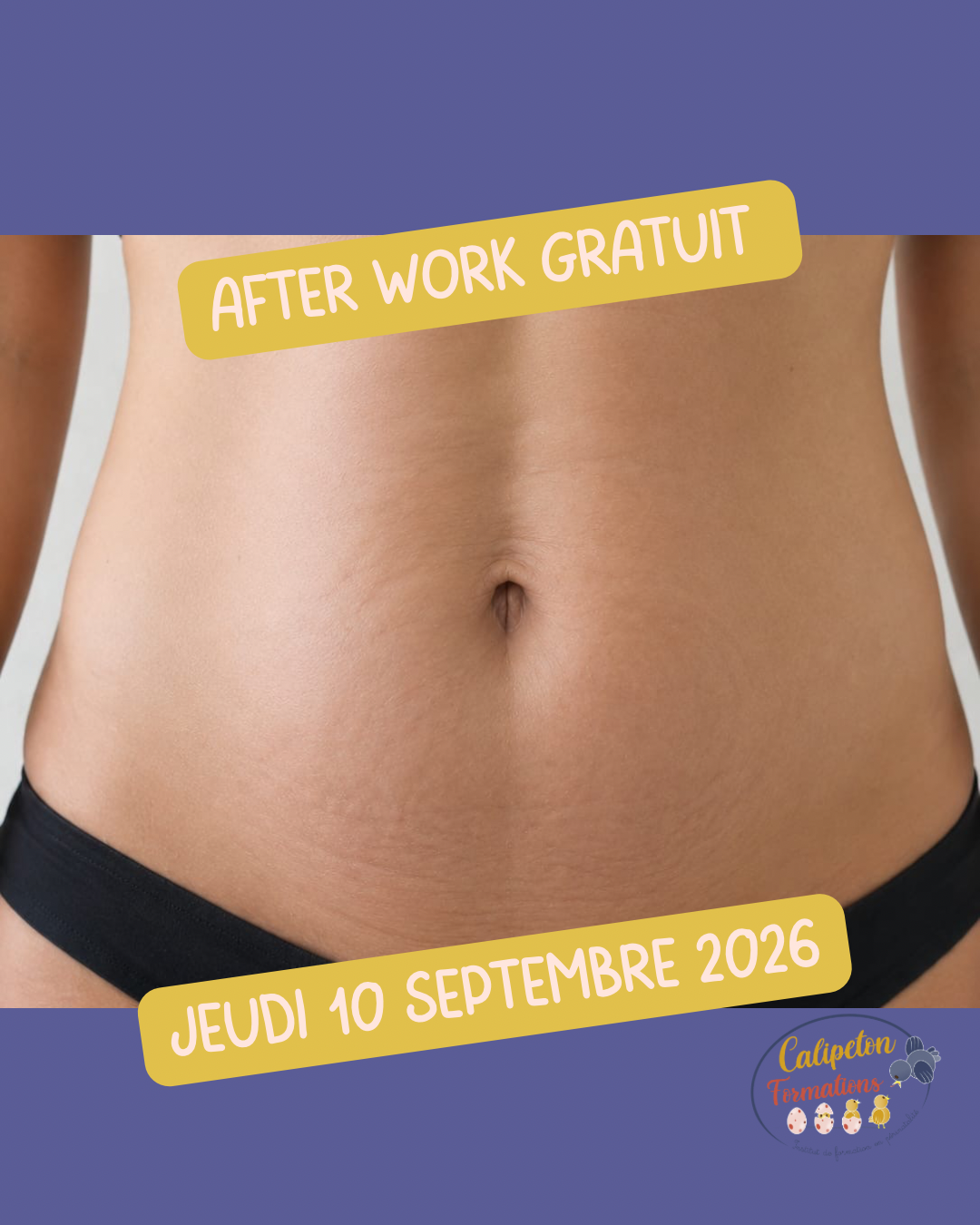 Afterwork : Diastasis des grands droits, du diagnostic à l'orientation : ce que dit vraiment la littérature